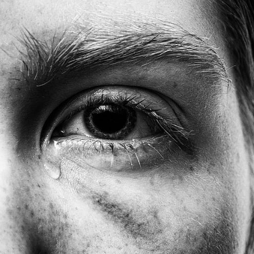 trauma repetitivo